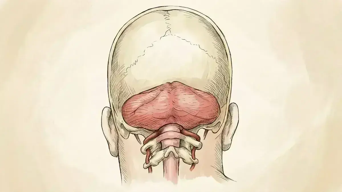 Cirurgia de Chiari (Descompressão da Fossa Posterior)