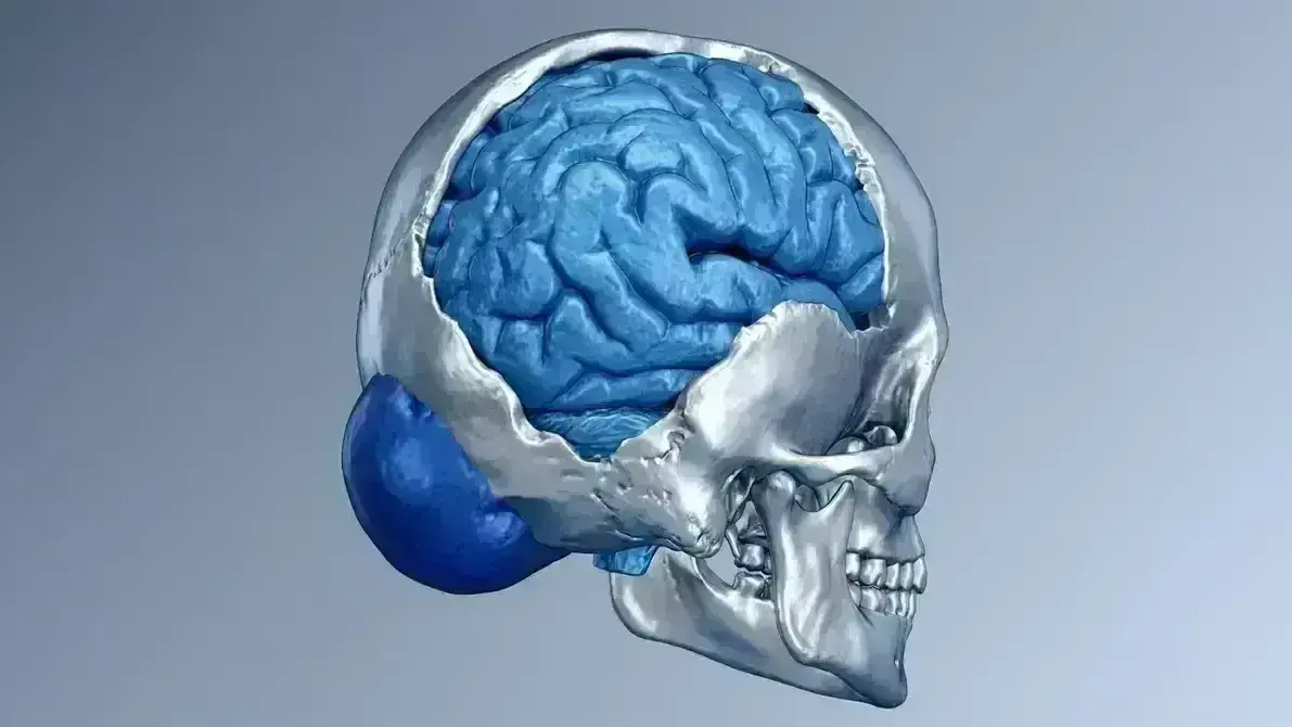 Ressecção e Correção de Encefalocele Occipital