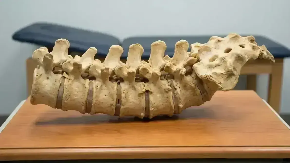 Doença Degenerativa Discal Lombar