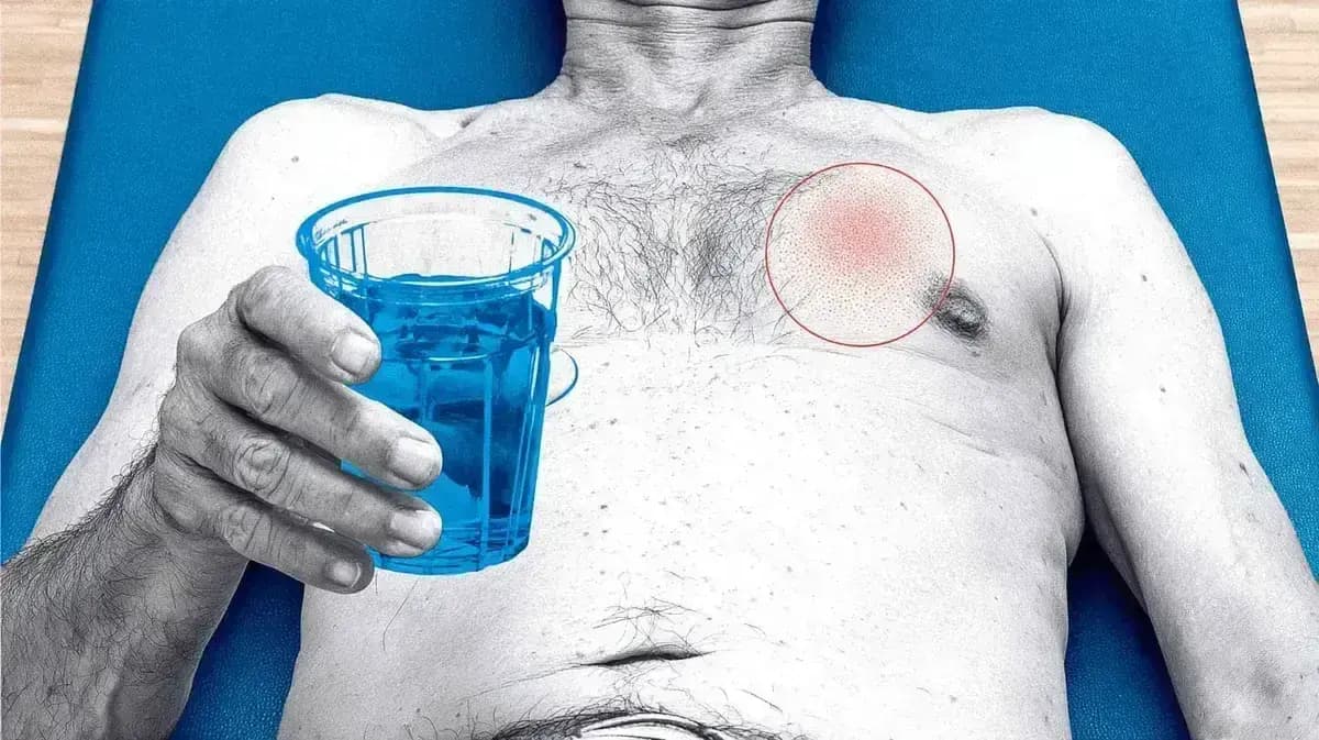 ☢️🔥 Dor Pós-Radiação