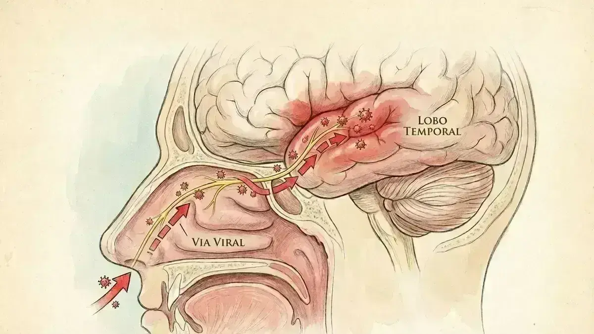 🧠 Encefalite Herpética