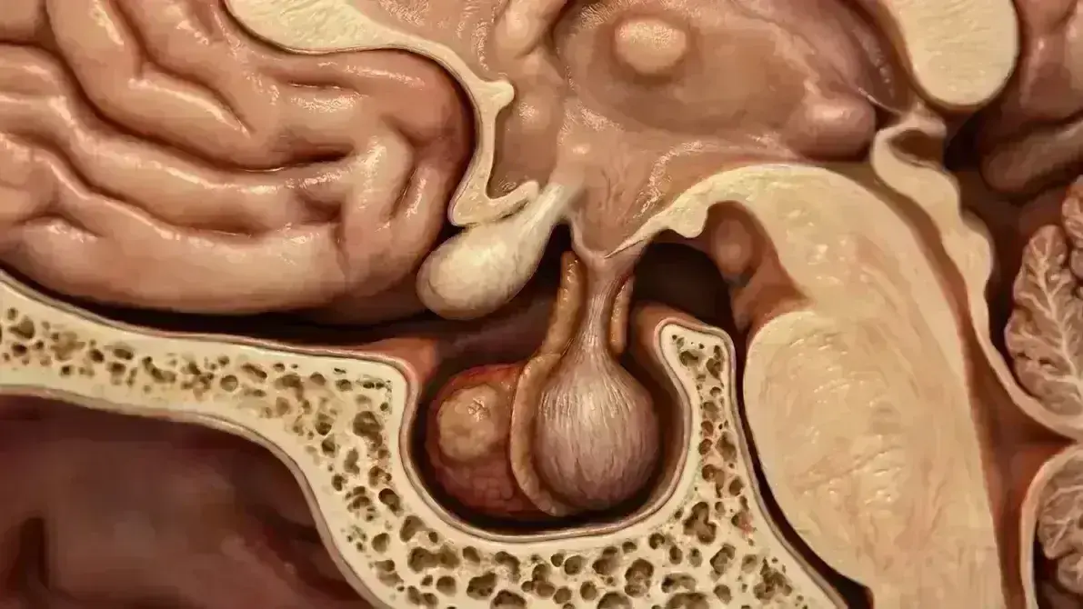 🤐👁️ Adenoma Hipofisário Não-Funcionante