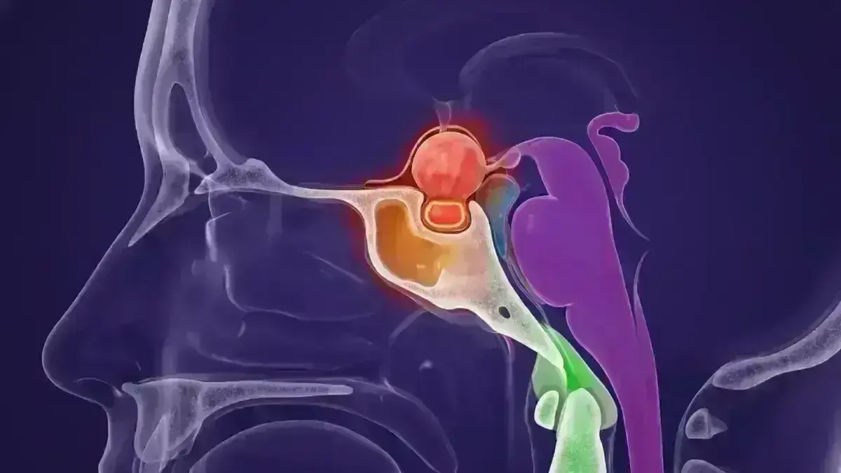 Adenoma Hipofisário